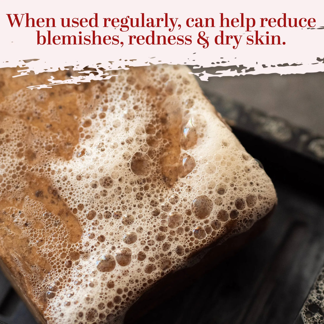 African Black Soap Bar Set