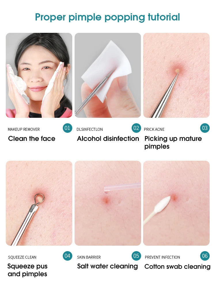 Nova Glam Essentials Professional Acne Tool Kit – Super-Pointed Blackhead Remover Needle, Ultra-Fine Tweezers & Cell Clip for Precision Extraction