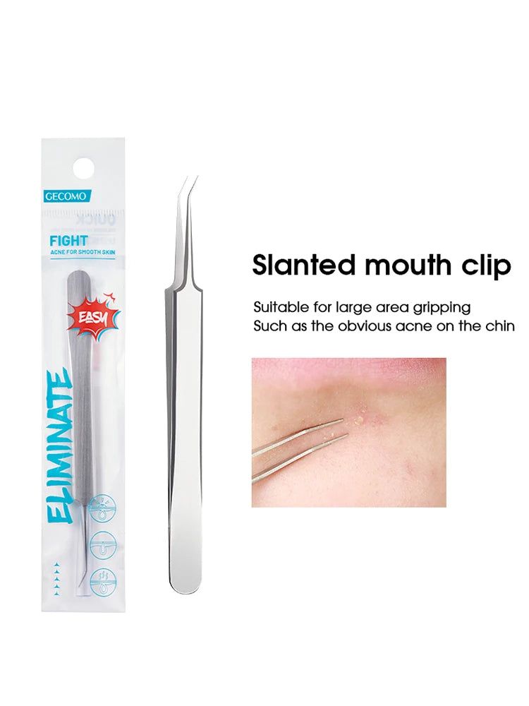Nova Glam Essentials Professional Acne Tool Kit – Super-Pointed Blackhead Remover Needle, Ultra-Fine Tweezers & Cell Clip for Precision Extraction