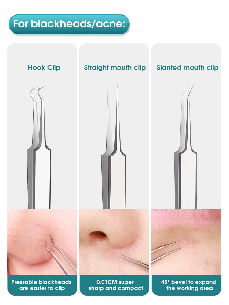 Nova Glam Essentials Professional Acne Tool Kit – Super-Pointed Blackhead Remover Needle, Ultra-Fine Tweezers & Cell Clip for Precision Extraction